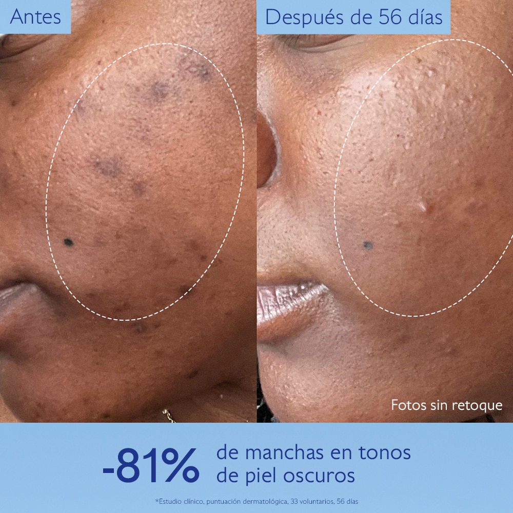 VINOPERFECT SERUM (SUERO ILUMINADOR ANTI-MANCHAS)
